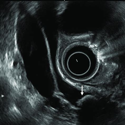 Pdf Imaging In Obstructive Jaundice What A Radiologist Needs To Know