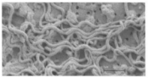 Syphilis Under Microscope