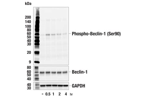 Phospho Beclin 1 Ser90 E3X1I Rabbit MAb Cell Signaling Technology