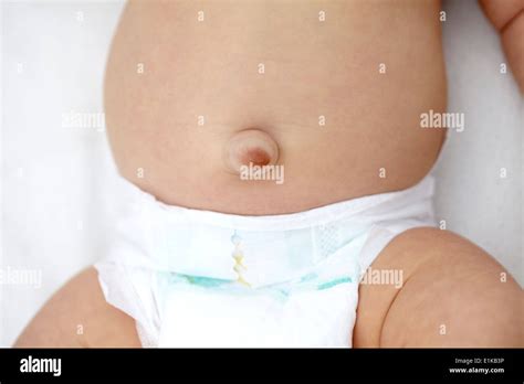 Umbilical View Hi Res Stock Photography And Images Alamy