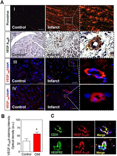 Immunohistochemistry Analysis Of Vegf A 165 B Expression In Heart