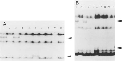 A Sscp Analysis Of Exon 14 Of The Ldl Receptor Gene In 10 Different