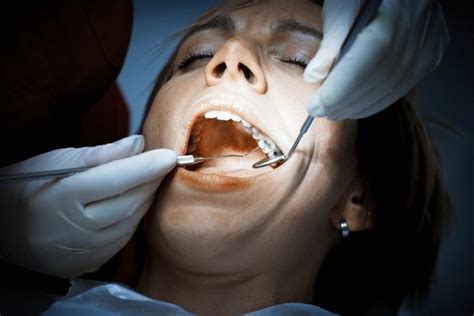 Pulpite Dente Inflamado O Que Sintomas Causas E Tratamento Tua