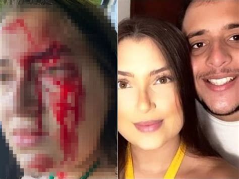 Filho de delegado é preso suspeito de agredir namorada