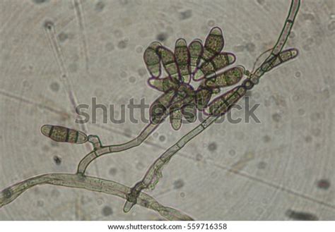 Curvularia Spores Stock Photo (Edit Now) 559716358