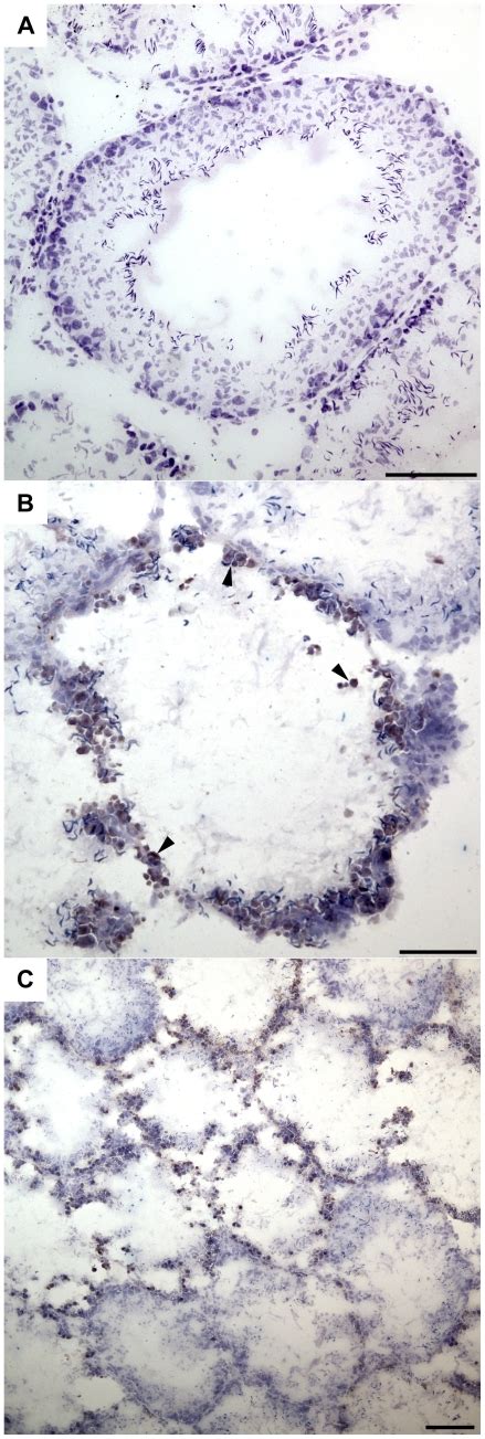 Tunel Staining Revealed The Presence Of Apoptotic Cells Dark Brown In