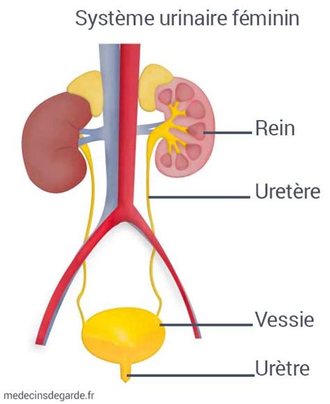 Comment Faire Pour Soigner Une Infection Urinaire