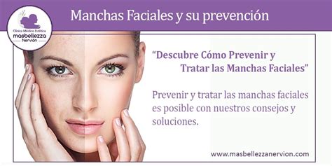 Manchas Faciales Y Su Prevenci N