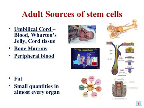 Donation Storage And Uses Of Umbilical Cord And Bone Marrow Stem Cel