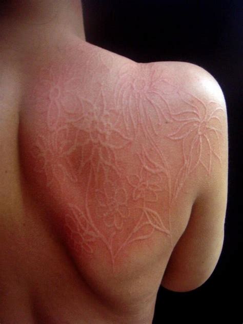 Scratches On Skin