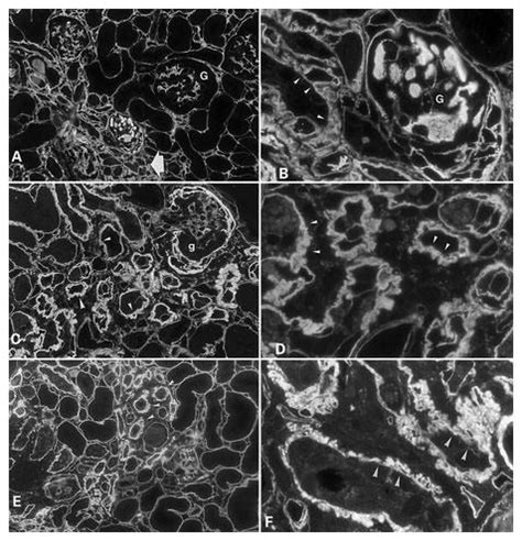 Immunofluorescence Staining For Fibronectin A B Collagen Type Iv