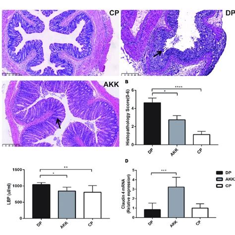 Akkermansia Muciniphila Exhibited Systemic And Intestinal