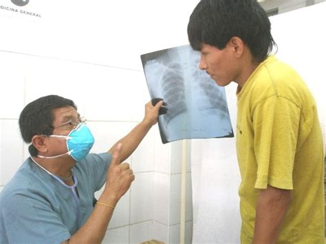 La Tuberculosis Pulmonar Es Curable Si Se Detecta A Tiempo El Portavoz