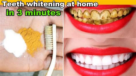 Teeth Whitening At Home In 3 Minutes How To Whiten Your Yellow Teeth Naturally 100 Youtube