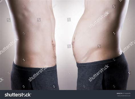 Man Before After Weight Loss Fat Stock Photo 311626478 | Shutterstock