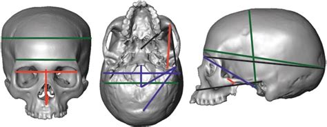 Frontal Lateral And Inferior Views Of A Human Skull Showing The Download Scientific Diagram