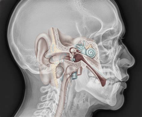 grommet surgery melbourne melbourne ent dr simon braham
