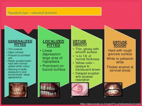 Amelogenesis imperfecta, hypoplastic type - Dr Sanjana Ravindra