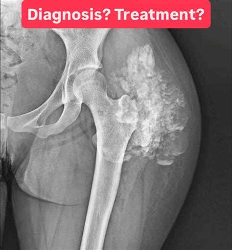 Medical - A 34-year-old patient presents with persistent pain and