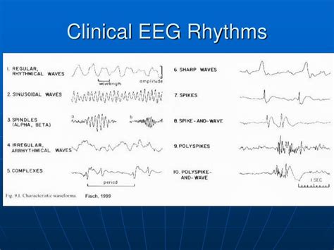 Ppt Clinical Eeg Rhythms Powerpoint Presentation Free Download Id