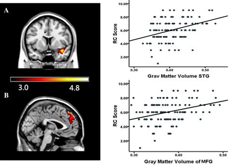 Regional Gray Matter Volume Correlated With Representation Connection