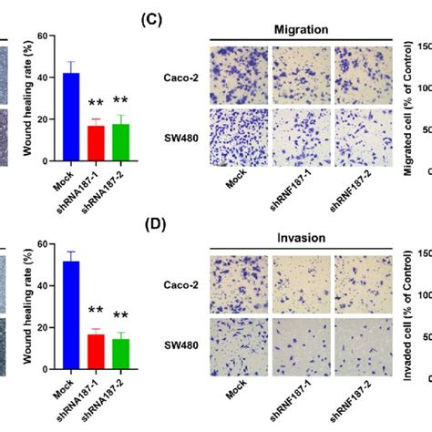 Silencing Rnf Inhibited The Motility Of Crc Cells Caco And Sw