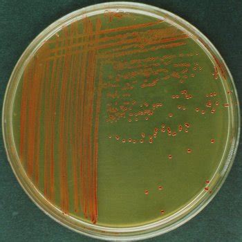 Enterococcus Agar