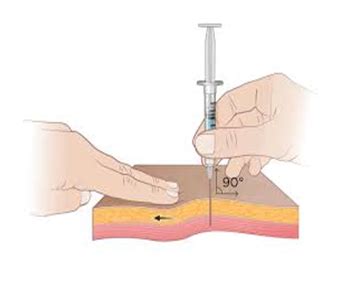 IRON INJECTION POLICY-Z-TRACK METHOD – Stoney Health Portal