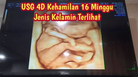 Mengenal Usg 4 Dimensi Manfaat Hingga Cara Membaca Hasilnya Porn Sex