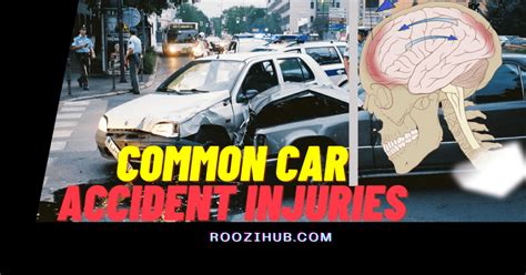 Common Car Accident Injuries Roozihub