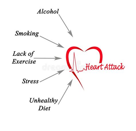 Causes Of Heart Disease Stock Illustration Illustration Of Style