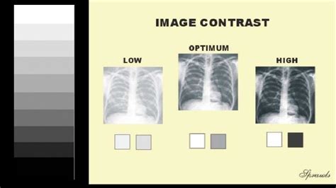 How to Read KUB Radiographs Presented by Dr