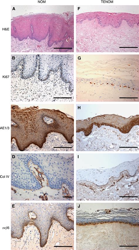 Representative Sections Of Normal Oral Mucosa Taken From Patient