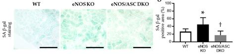 Aged ENOS KO Accelerated Mitochondrial Damage And Cellular Senescence