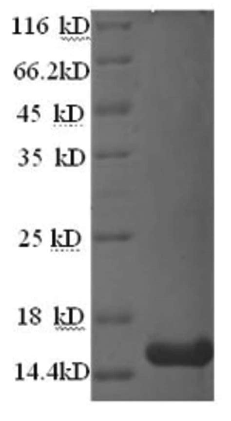 Enquirebio Recombinant Human Glp R Glp R Protein G Enquirebio