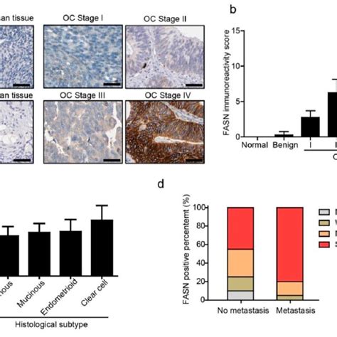 Mechanism Of Fasn Controlling Emt In Ovarian Cancer A Model Is