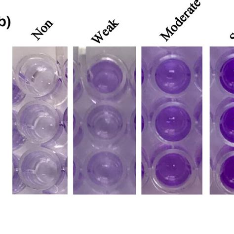 Biofilmforming Capacity Of Pseudomonas Aeruginosa Pulmonary Isolates