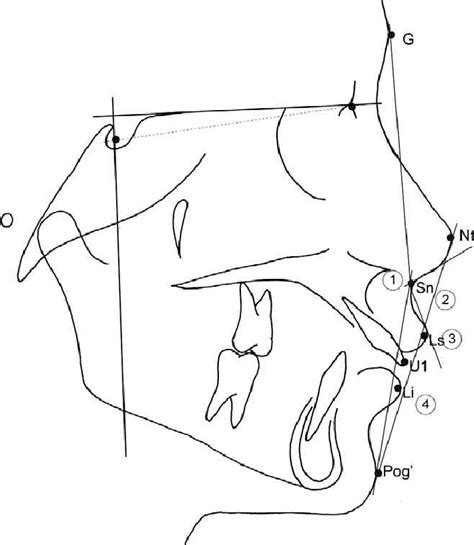 Soft Tissue Parameters A Angular Measurements U 1 G Sn Pg 2 Download Scientific