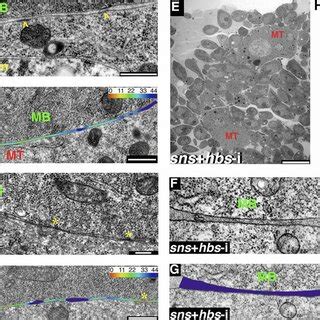 Dlm Myotubemyoblast Association And Contact Involves Several Distinct