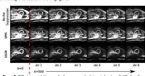 Figure 2 From In Vivo High Resolution Diffusion Tensor Imaging Of The