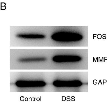 DSS Induced HT29 Cells Exhibited Increased FOSL1 And MMP13 Expression