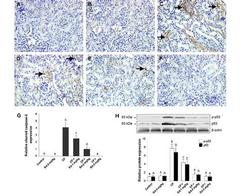 Cleaved Caspase 3 Expression In The Corticomedullary Junction Of Mice