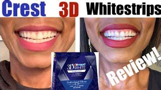 Do Crest Whitening Strips Work On Fillings Very Nice To Look At Forum