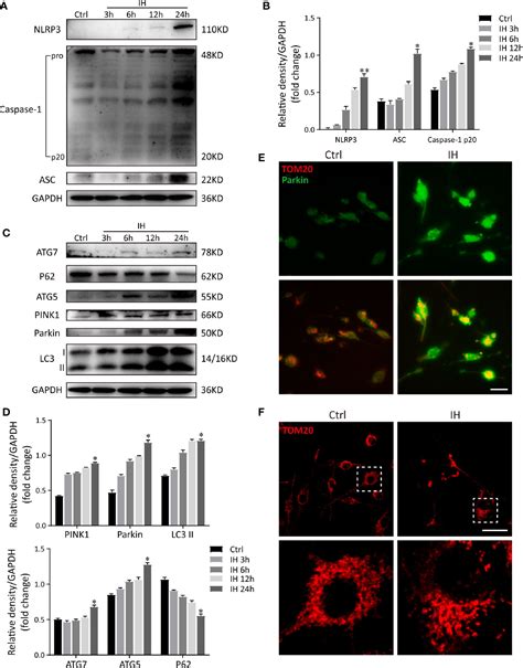 Frontiers Nlrp Deficiency Protects Against Intermittent Hypoxia