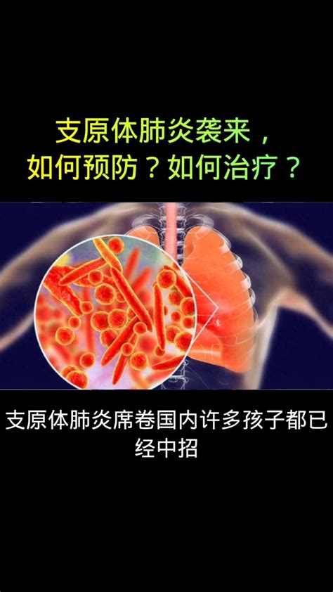 支原体肺炎来袭，如何预防？如何治疗？高清1080p在线观看平台腾讯视频