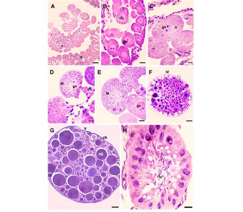 Histological Sections Of Ovaries Of Rhipicephalus Sanguineus Females