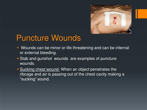 Ppt Chapter 14 Powerpoint Presentation Free Download Id2135282