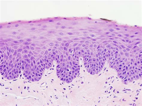 Histology Of Larynx