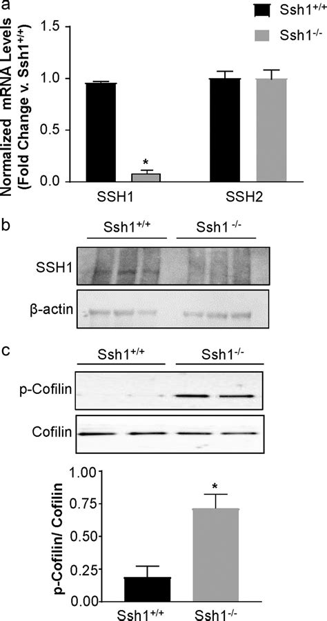 The Cofilin Phosphatase Slingshot Homolog Restrains Angiotensin Ii