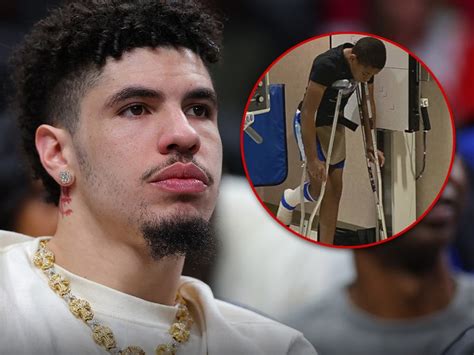 Lamelo Ball é Processado Após Supostamente Dirigir E Quebrar O Pé De Um